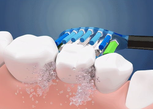 電動(dòng)牙刷如何選擇 全方位指南，助力牙齒清潔健康